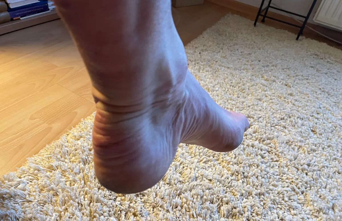 Úrazy Achillovy šlachy. Jak jim předcházet a jak je léčit